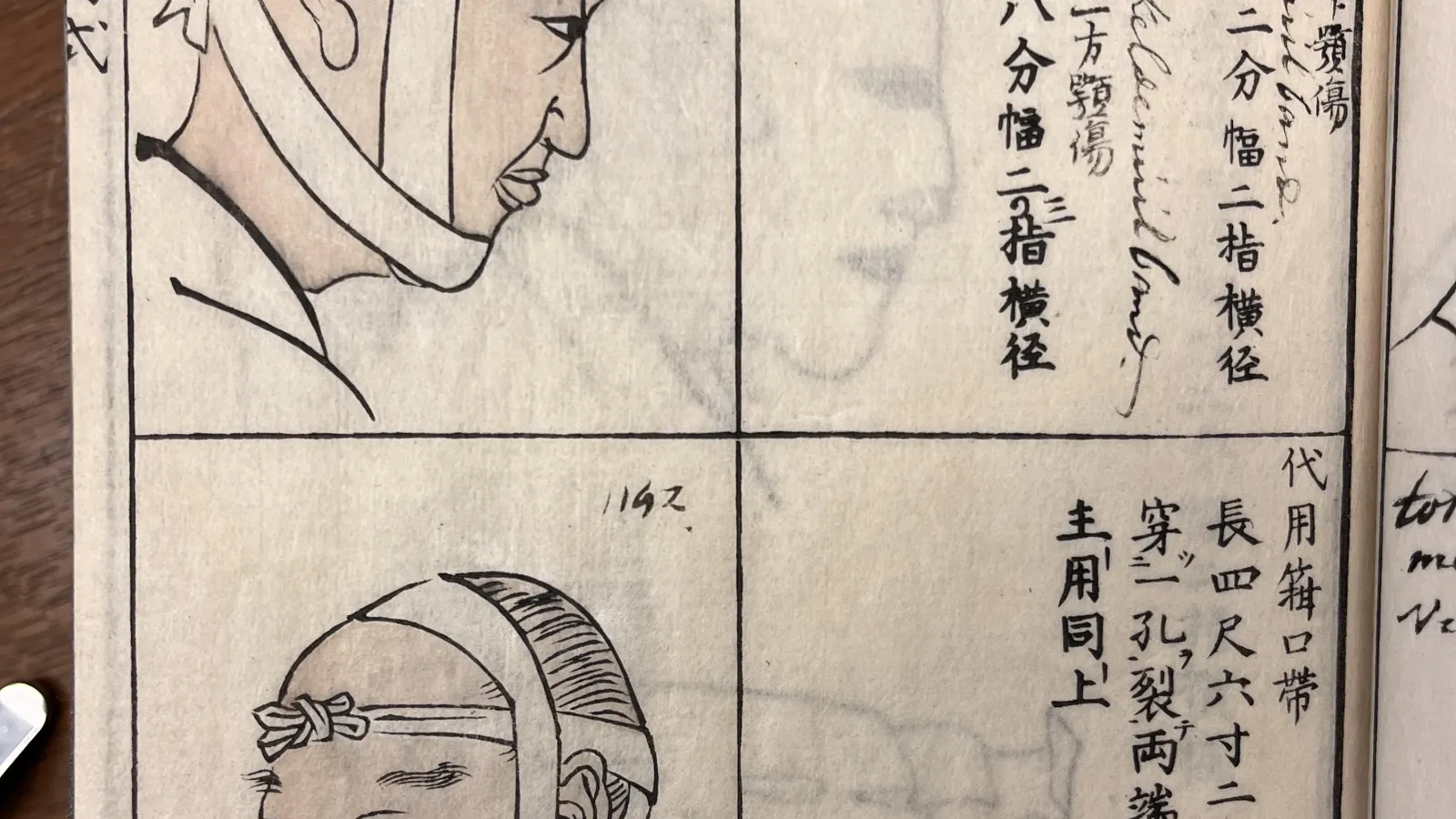 One box with four quadrants featuring two illustrations of a male patients head wrapped in bandages, and two panels featuring Japanese characters.